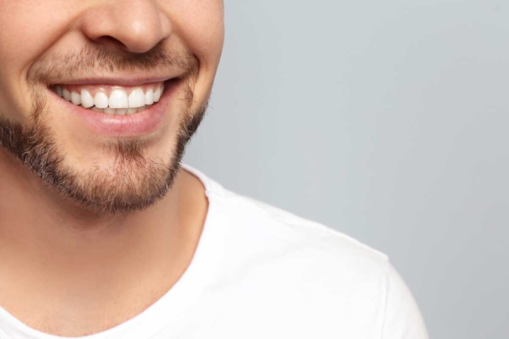 the benefits of cosmetic bonding Oldbury smile spa