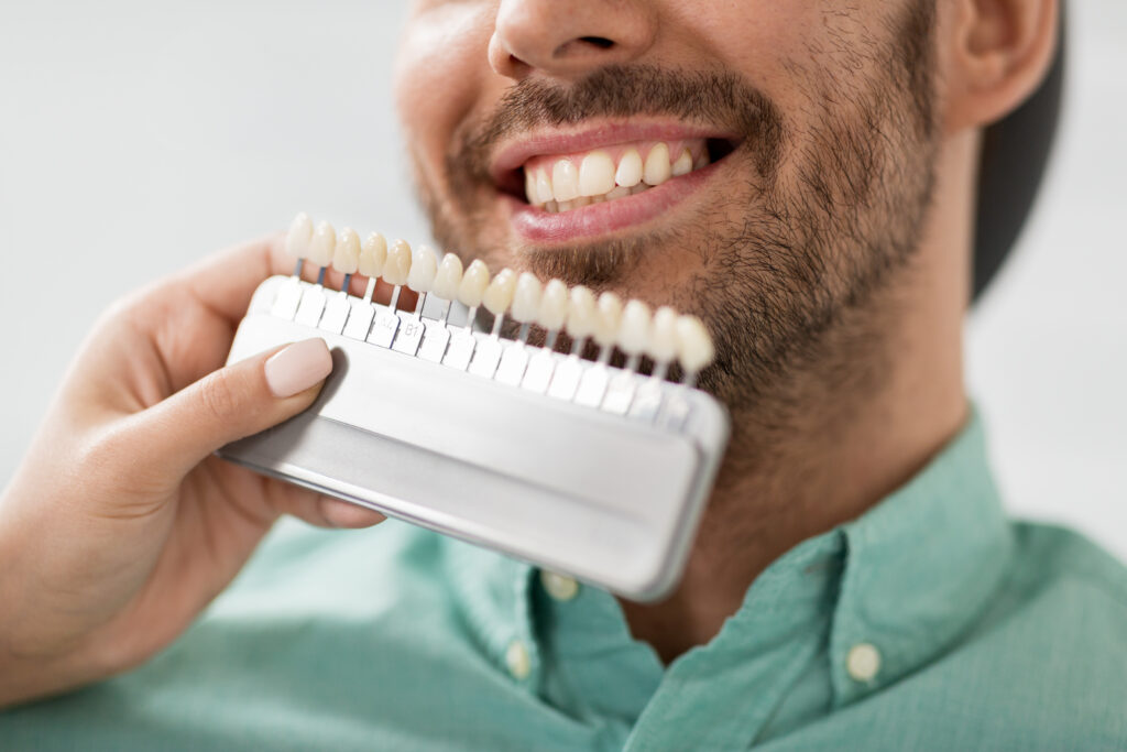 what is the process of getting veneers