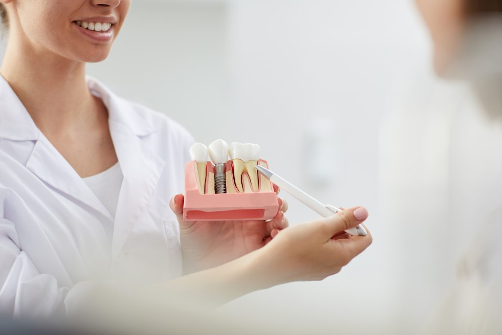 woman holding up figure of dental implantation whilst pointing and smiling
