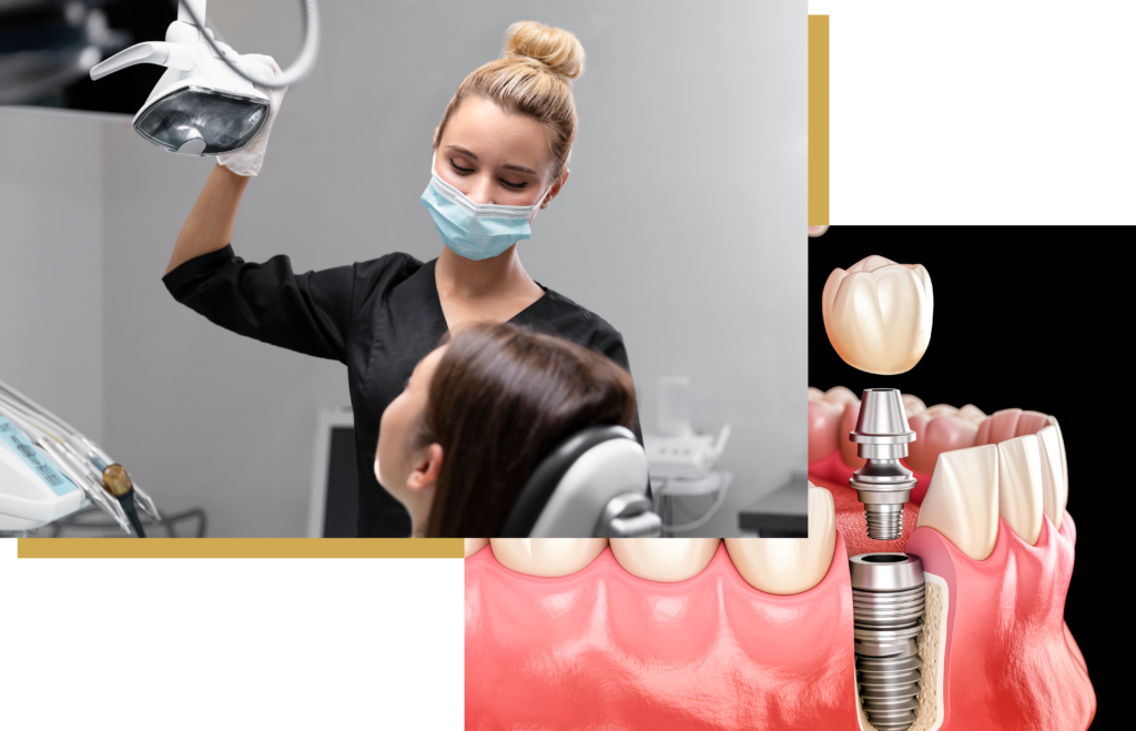 Dental Implant Oldbury